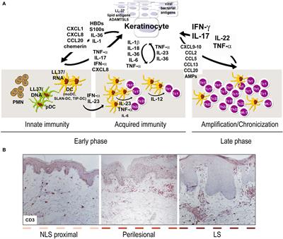 The Interplay Between Keratinocytes and Immune Cells in the Pathogenesis of Psoriasis